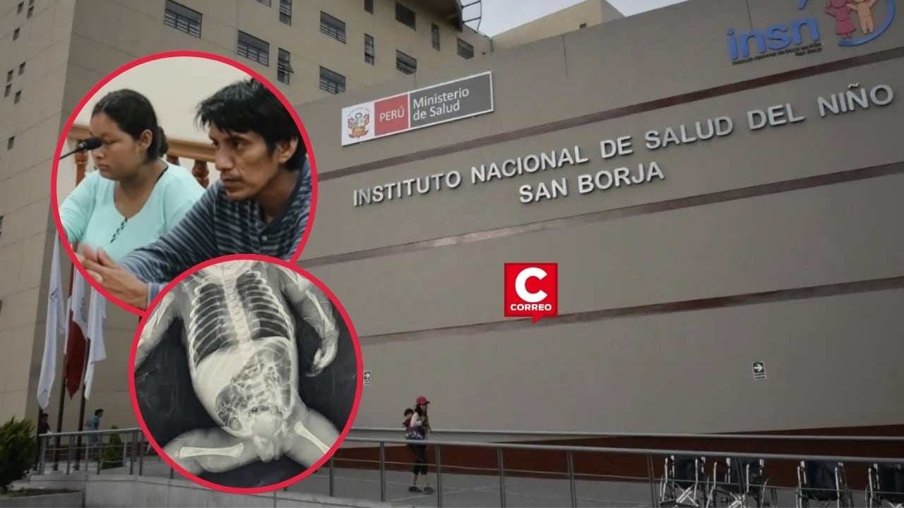 Bebé maltratada por sus padres en Chimbote llegó al Instituto del Niño con fracturas y desnutrición. Composición: Diario Correo.