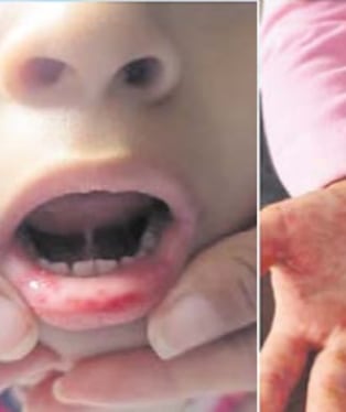 Exigen extremar medidas de higiene en menores.