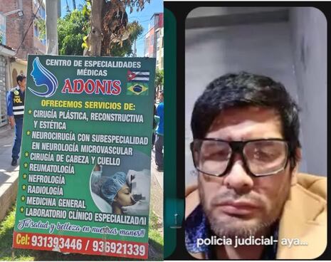 Fiscalía logra prisión preventiva para médico investigado por desfigurar a menor de 16 años