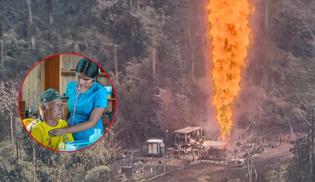 Cusco: Ardor en la piel, problemas digestivos y ansiedad tras deflagración de gas