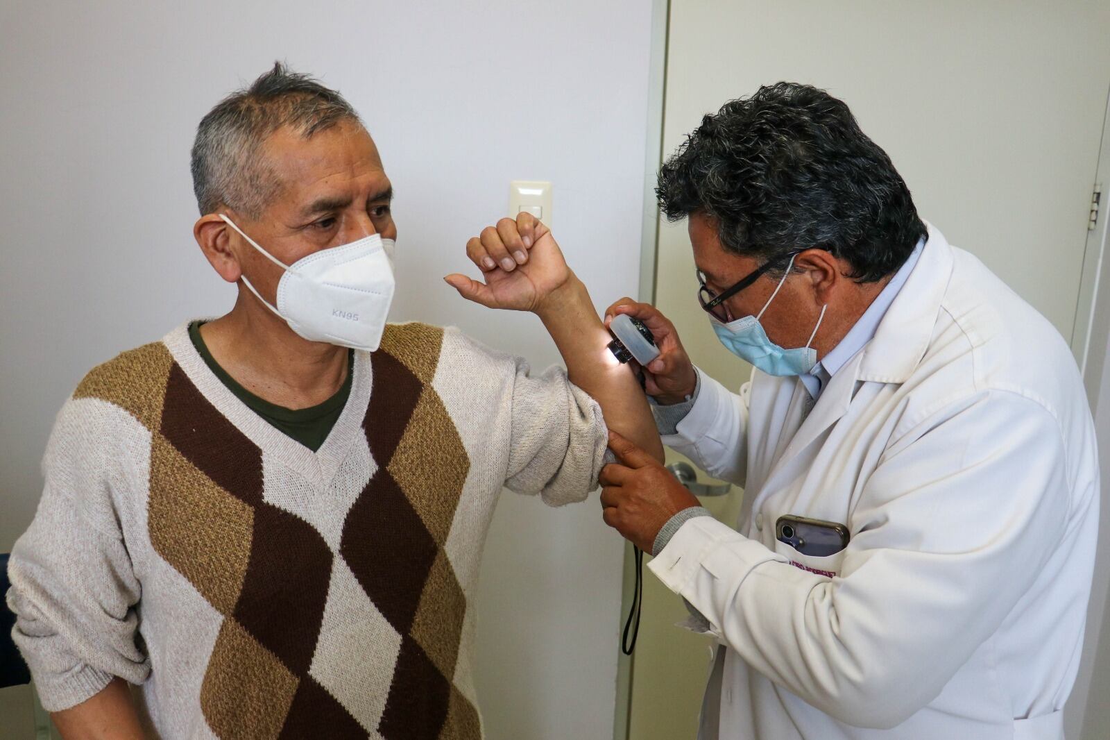 Huancayo: Hasta cuatro casos de cáncer de piel atiende Hospital Carrión cada semana