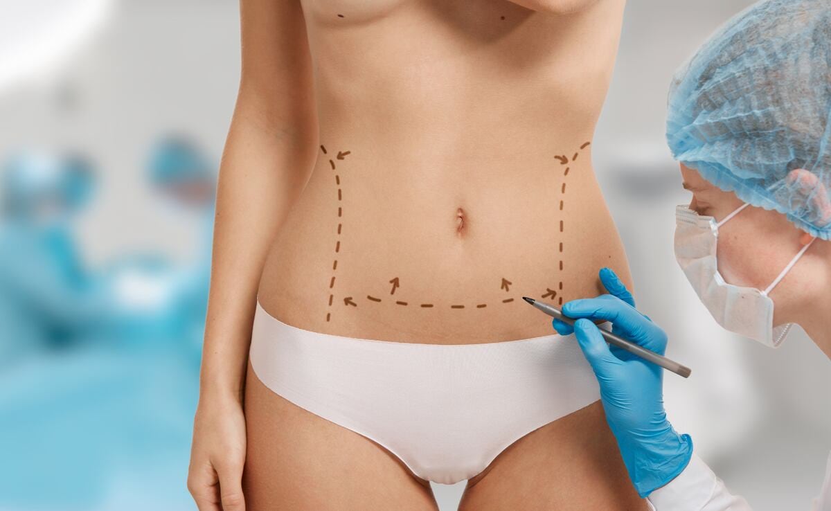 Cirugía estética, cuando la belleza cuesta la vida
(Foto: Freepik)