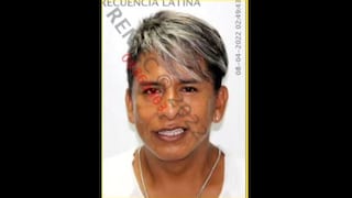 La Molina: hallan cadáver de estilista maniatado y degollado dentro de su vivienda