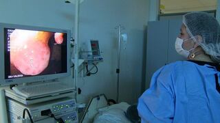 Aumenta demanda de consultas por cáncer de colon en los hospitales de la región Ica  