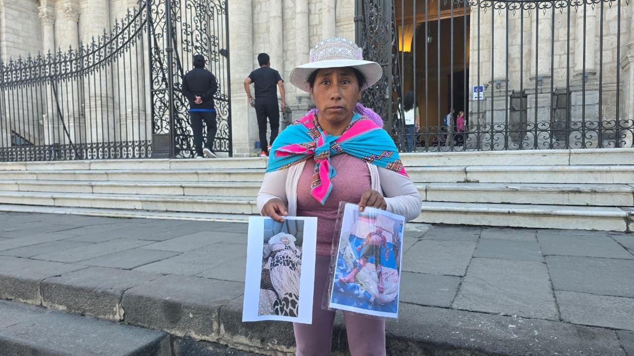 El cáncer cambió la vida de una familia: madre arequipeña pide ayuda para afrontar gastos (Foto: Yunsu Pariapaza/@photo.gec)