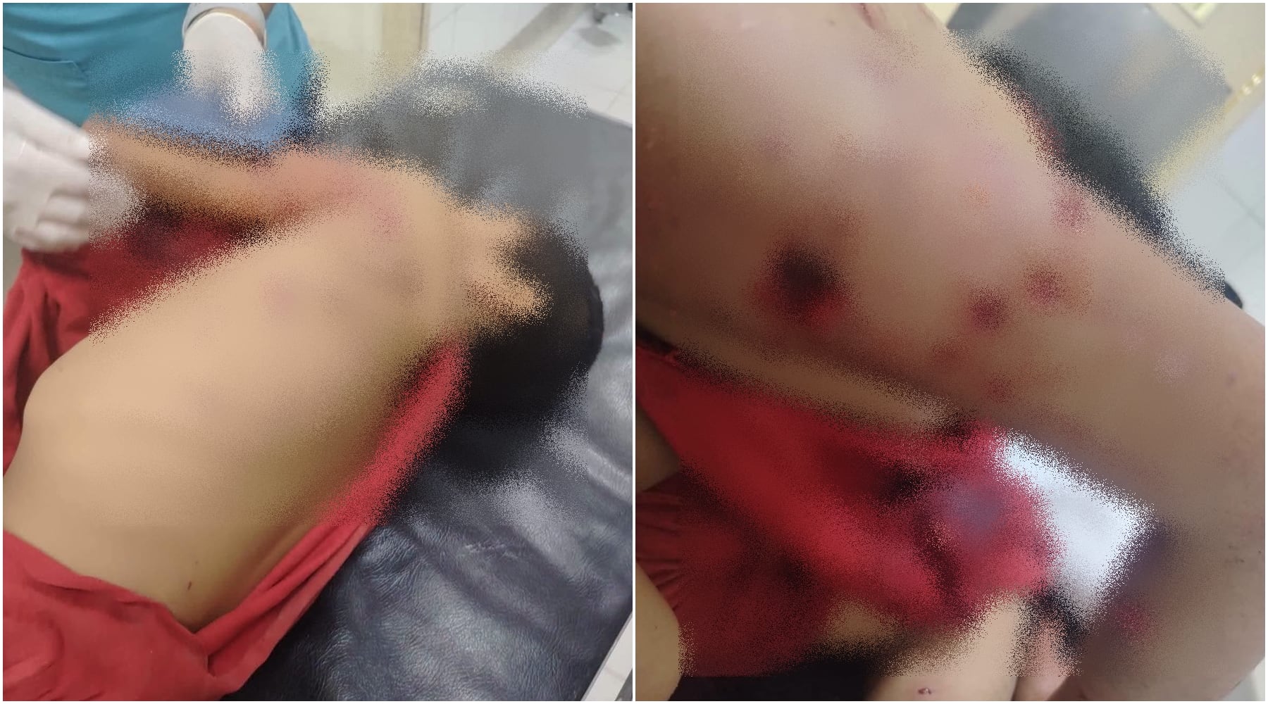 Chincha: niño resulta gravemente herido tras ser atacado por un perro de raza peligrosa