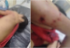 Chincha: niño resulta gravemente herido tras ser atacado por un perro de raza peligrosa