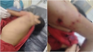 Chincha: niño resulta gravemente herido tras ser atacado por un perro de raza peligrosa
