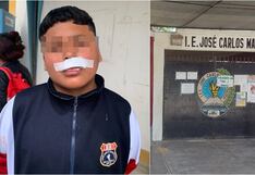 Pisco: menor es atacado por perro en el colegio José Carlos Mariátegui