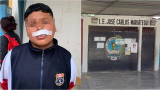 Pisco: menor es atacado por perro en el colegio José Carlos Mariátegui