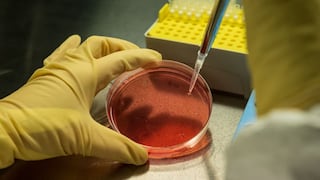 Descubren las células responsables de la metástasis en el cáncer del colón