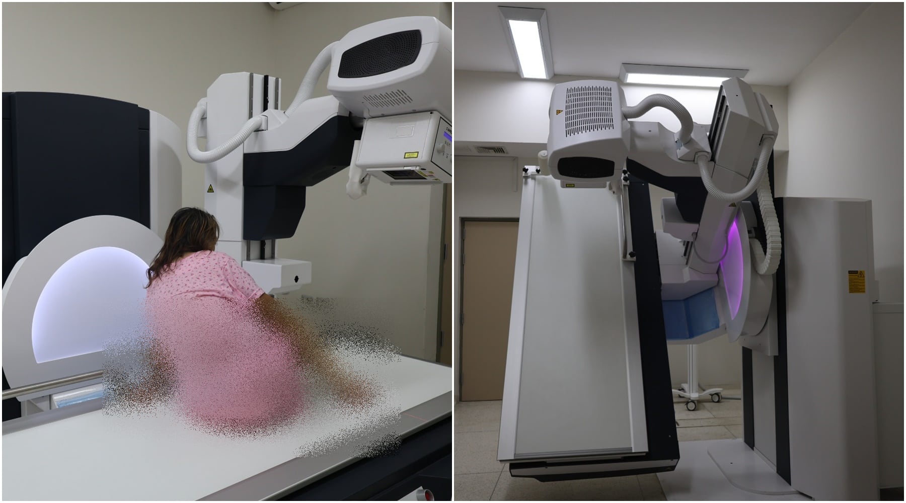 Ica: atienden a cerca de 500 pacientes con nuevo equipo de Rayos X con fluoroscopia