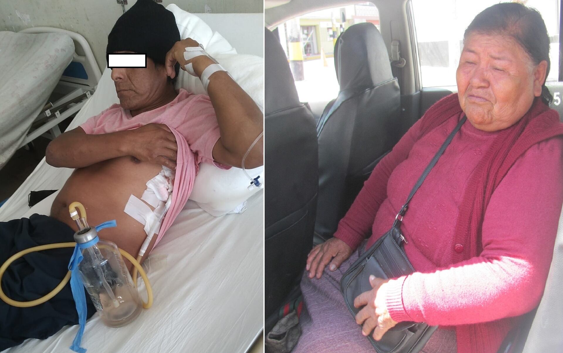 Marco Mamani permanece en el hospital Unanue y su madre anciana pide no lo dejen desprotegido