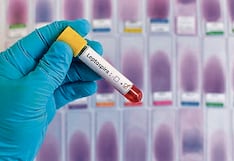 Piura es la segunda región con más casos de leptospirosis