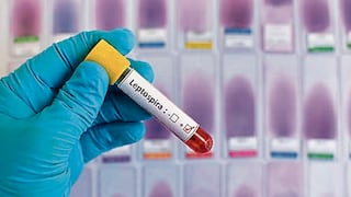 Piura es la segunda región con más casos de leptospirosis