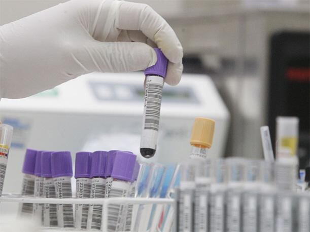 Se trata de una enfermedad neurológica que afecta los nervios periféricos, y que puede llevar a una debilidad muscular progresiva e incluso parálisis. (Foto: Agencia Andina)