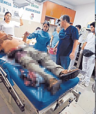 Herido fue llevado a centro de salud para atención.