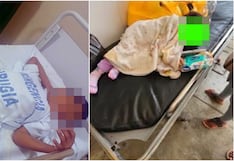 Chincha: padres y sus hijas heridas por brutal accidente entre motocicleta y auto