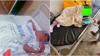 Chincha: padres y sus hijas heridas por brutal accidente entre motocicleta y auto