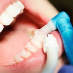 Flúor en pastas dentales: estudio confirma su seguridad