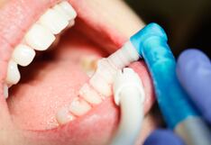 Flúor en pastas dentales: estudio confirma su seguridad