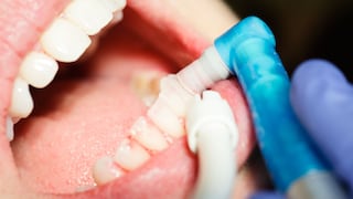 Flúor en pastas dentales: estudio confirma su seguridad