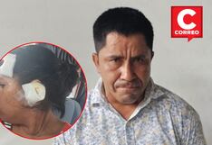 Chanchamayo: Sujeto le dispara a mujer y bala le pasa rozando la oreja