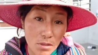 Pisco: niña con “piel de mariposa” necesita ser referida a un hospital de mayor complejidad en Lima