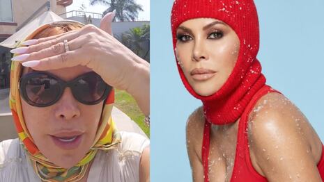 Sin fecha de retorno: Magaly Medina detalla su proceso de recuperación tras cirugía facial