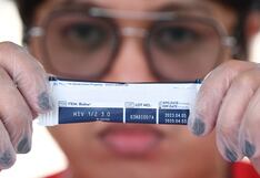 Día Mundial de Lucha contra el Sida: Más de seis mil casos de VIH se registra de enero a octubre del 2024