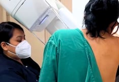 Hospital Santa Rosa ofrece mamografías gratis en marzo para mujeres de 40 a 69 años