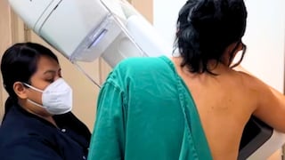 Hospital Santa Rosa ofrece mamografías gratis en marzo para mujeres de 40 a 69 años
