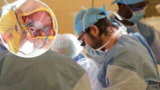Médicos logran realizar el primer trasplante de pene y escroto del mundo (VIDEO) 