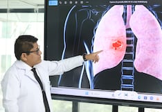 Adenocarcinoma pulmonar: EsSalud explica cómo se detecta y cuánto tarda la recuperación