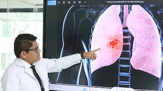 Adenocarcinoma pulmonar: EsSalud explica cómo se detecta y cuánto tarda la recuperación
