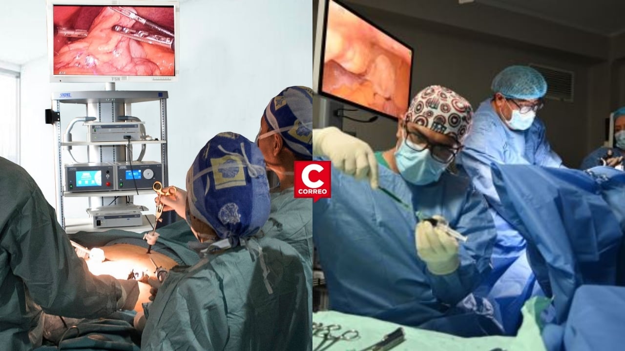 Hospital Cayetano Heredia realiza la primera cirugía laparoscópica para cáncer de endometrio en el Perú. Composición: Diario Correo.