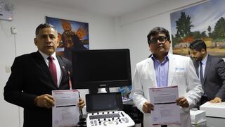 EsSalud Ica recibe moderno ecógrafo tras convenio de intercambio prestacional