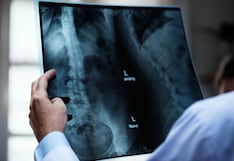¿Recibes más radiación en un avión o en una radiografía? Esto dicen los expertos