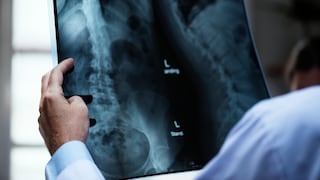 ¿Recibes más radiación en un avión o en una radiografía? Esto dicen los expertos