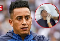 Christian Cueva genera reacciones tras someterse a procedimiento estético facial