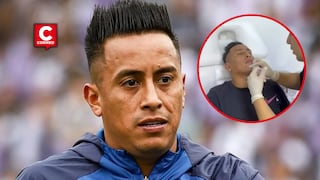 Christian Cueva genera reacciones tras someterse a procedimiento estético facial