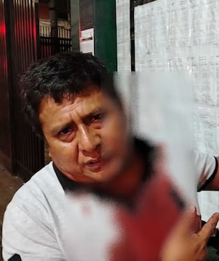 Chincha: policía en presunto estado de ebriedad le rompe la cabeza con arma de fuego