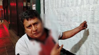 Chincha: policía en presunto estado de ebriedad le rompe la cabeza con arma de fuego