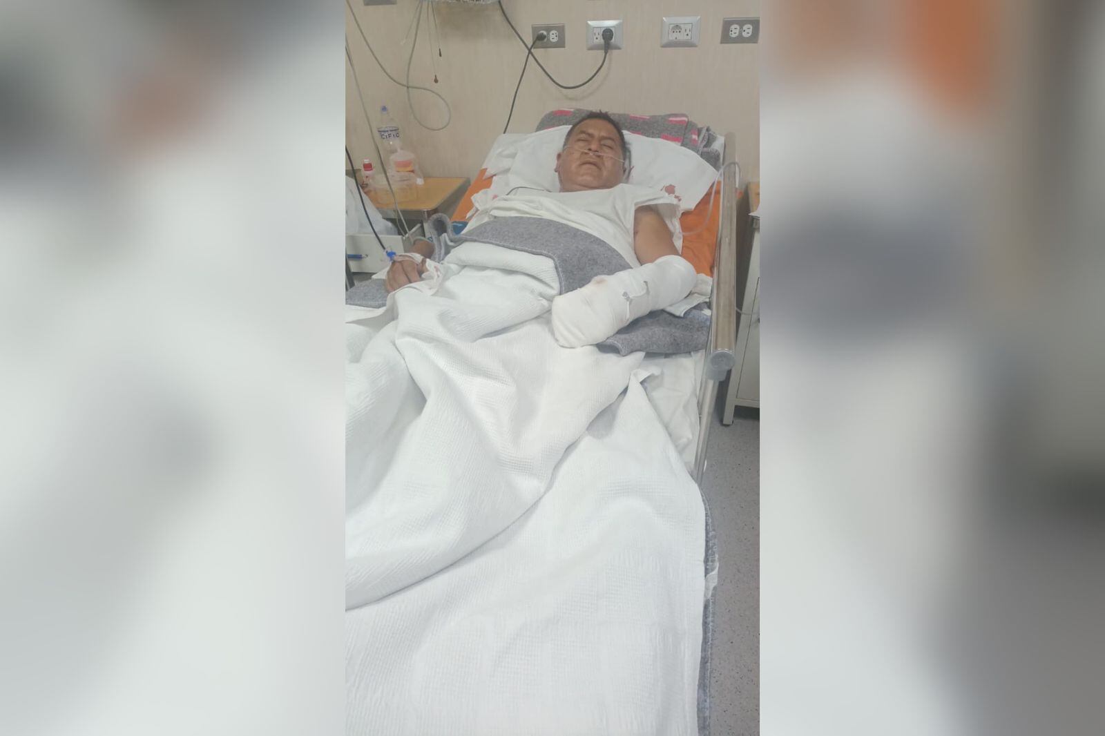 Dirigente herido fue trasladado al hospital Honorio Delgado en donde se viene recuperando. (Foto: GEC)