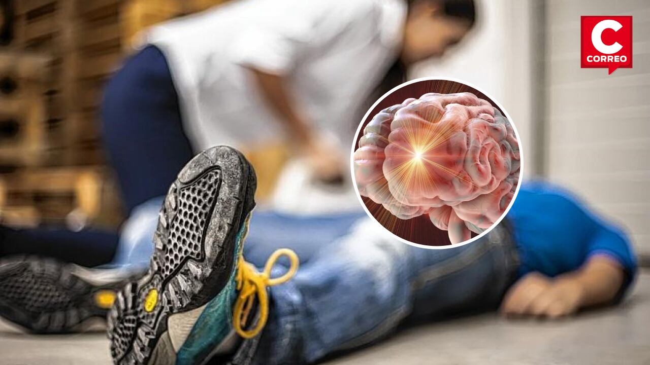 ¿Cómo tratar la epilepsia?