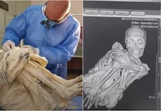 Han pasado 7 años y continúa la polémica por las “momias tridáctilas de Nasca”