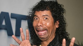 Cachay es agredido en show: Cómico fue internado tras terminar con fractura en la muñeca
