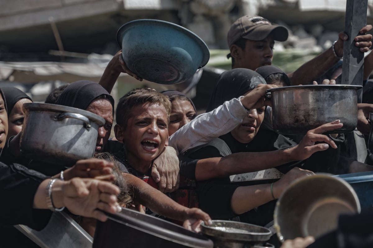 El organismo de la ONU reportó una ligera reducción del hambre respecto a años anteriores, aunque advirtió que la guerra en Oriente Medio y los efectos del cambio climático podrían frenar los avances alcanzados. (Foto: EFE/UNICEF/Mohammed Nateel)