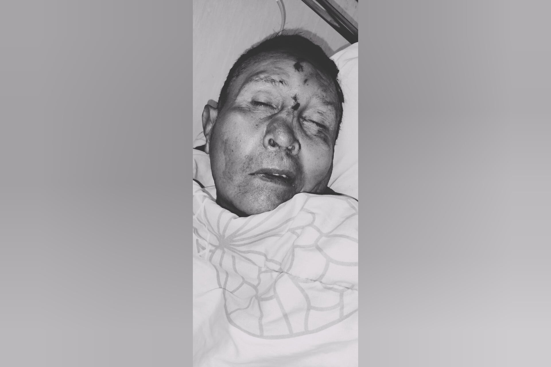 Buscan a familiares de paciente internado en situación de gravedad (Foto: Hospital Honorio Delgado Espinoza)