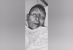 Buscan a familiares de paciente internado en el hospital Honorio Delgado en Arequipa